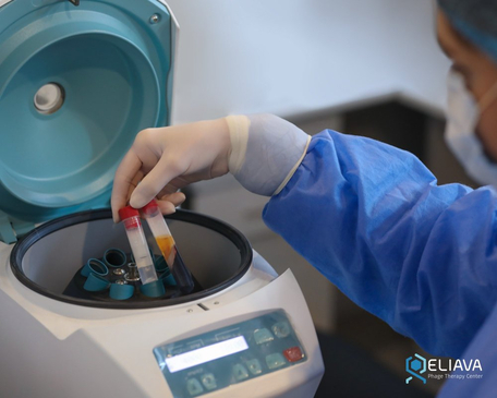 Slider image (5) Eliava Phage Therapy Center